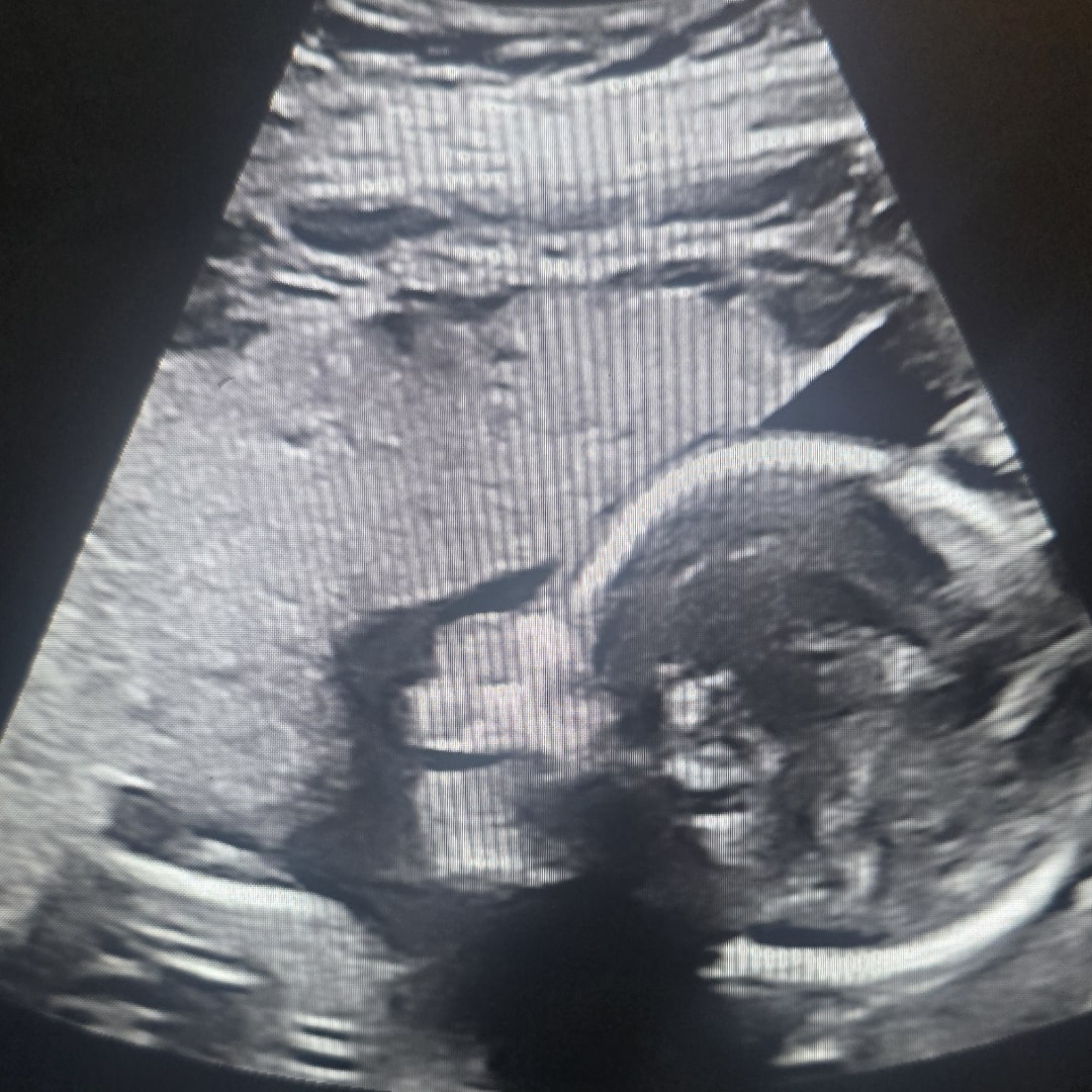 Photo shared by Amanda for their Babylist baby registry.