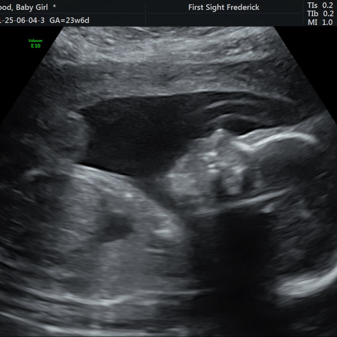 Photo shared by Ally for their Babylist baby registry.