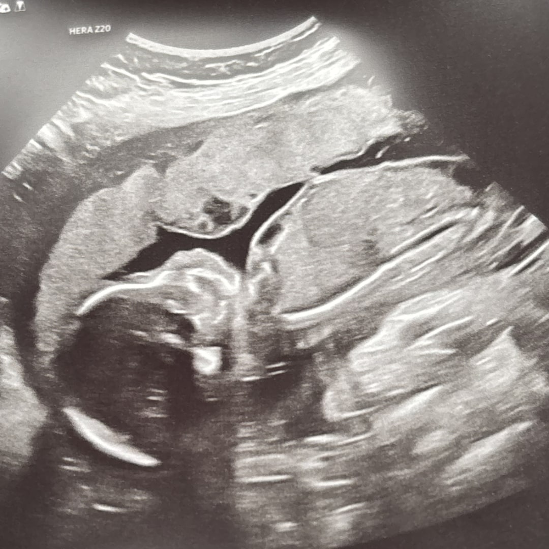 Photo shared by Arianna for their Babylist baby registry.