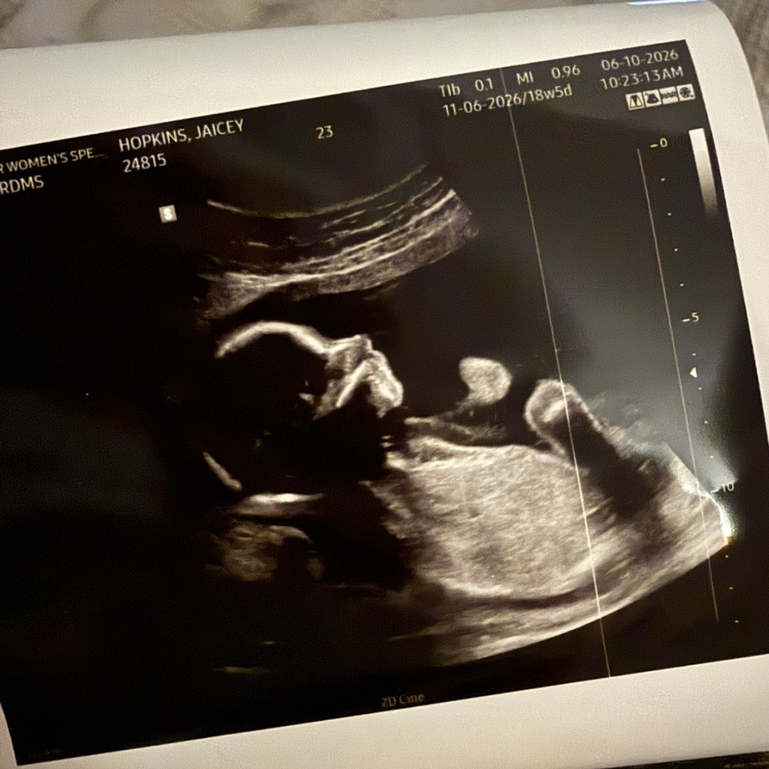 Photo shared by Jaicey for their Babylist baby registry.