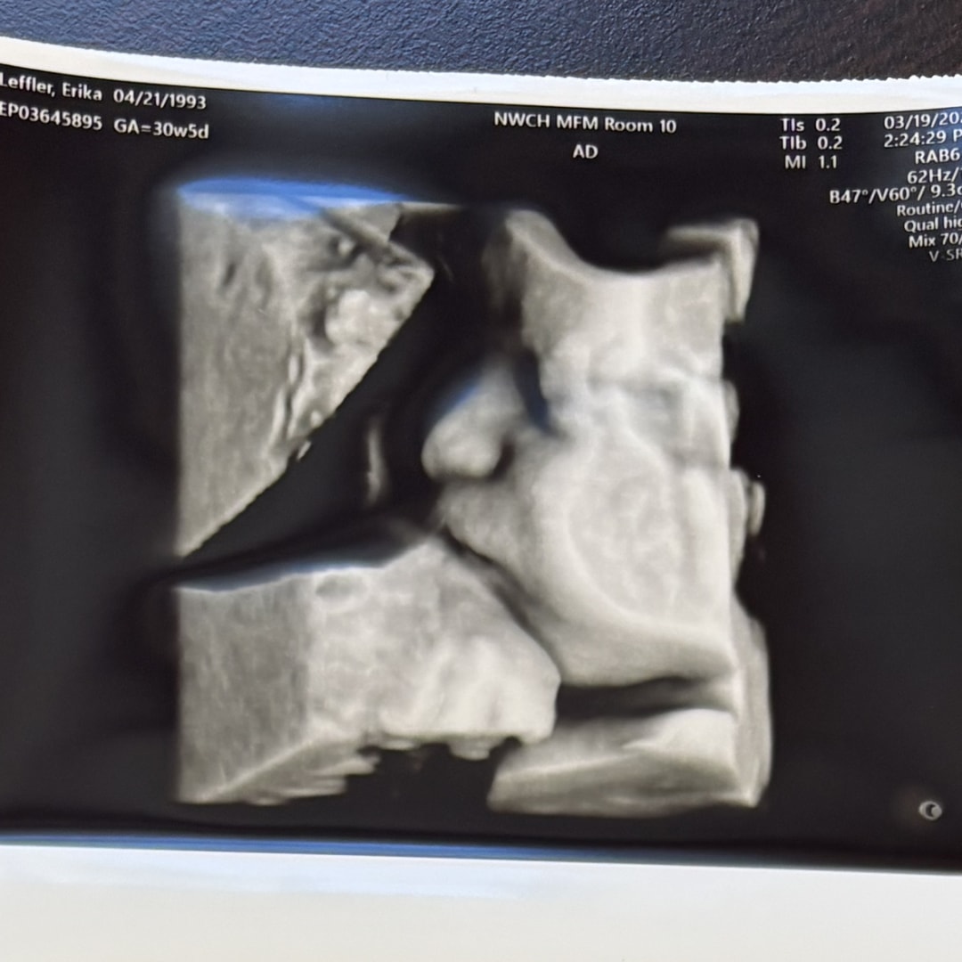 Photo shared by Erika for their Babylist baby registry.