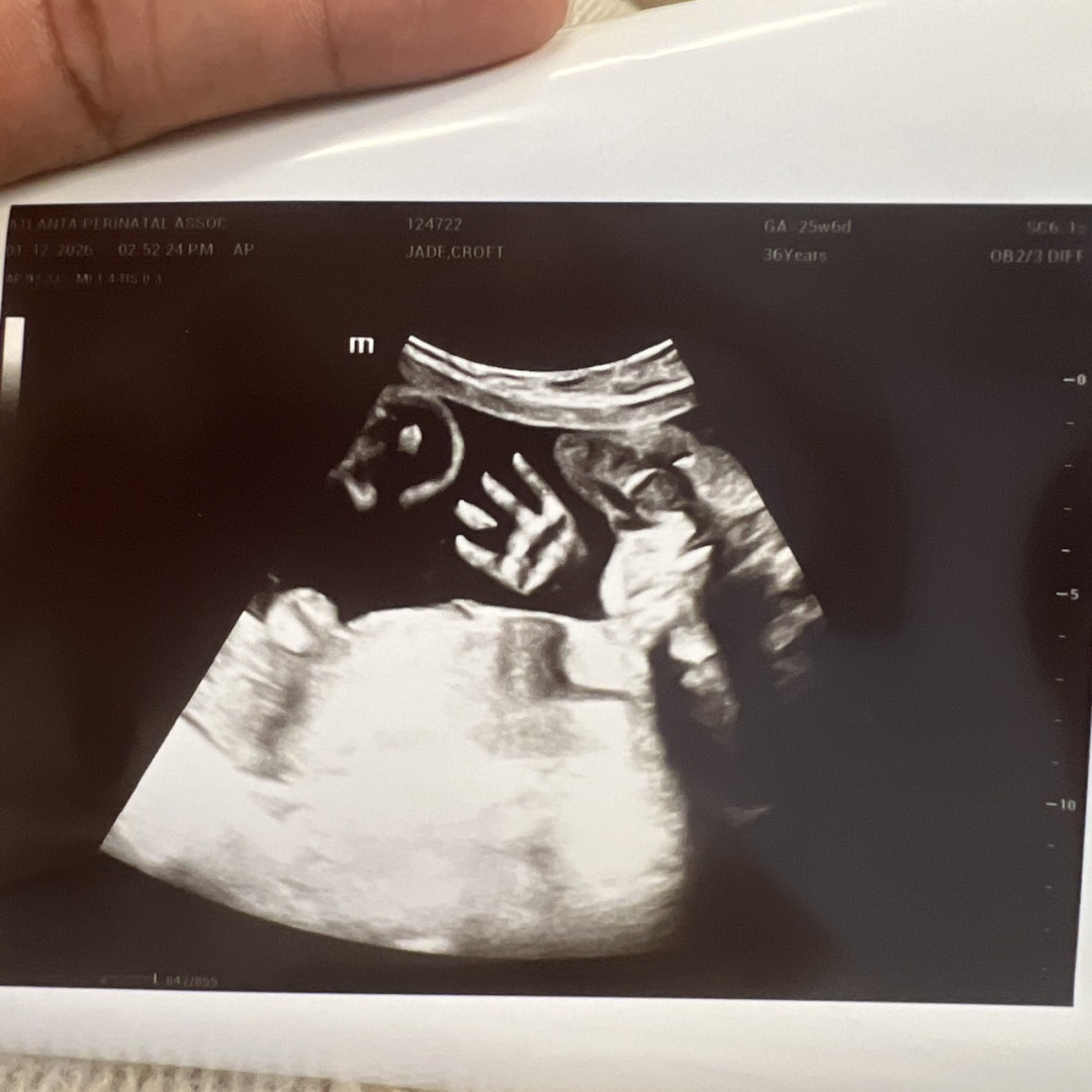 Photo shared by Jade for their Babylist baby registry.