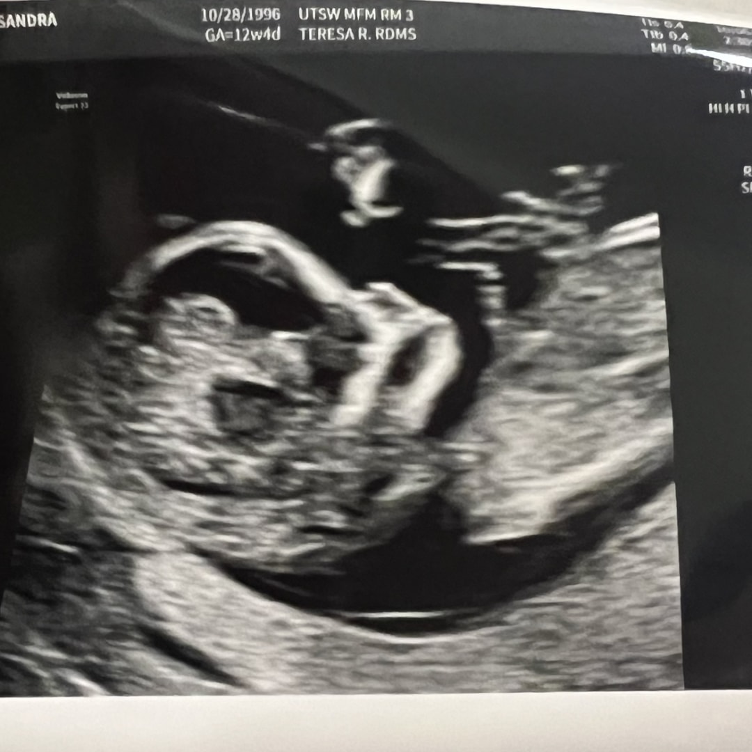 Photo shared by Alessandra for their Babylist baby registry.