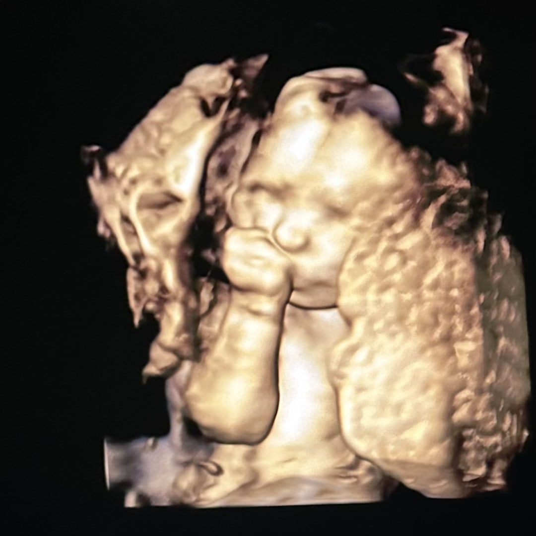 Photo shared by Emily for their Babylist baby registry.