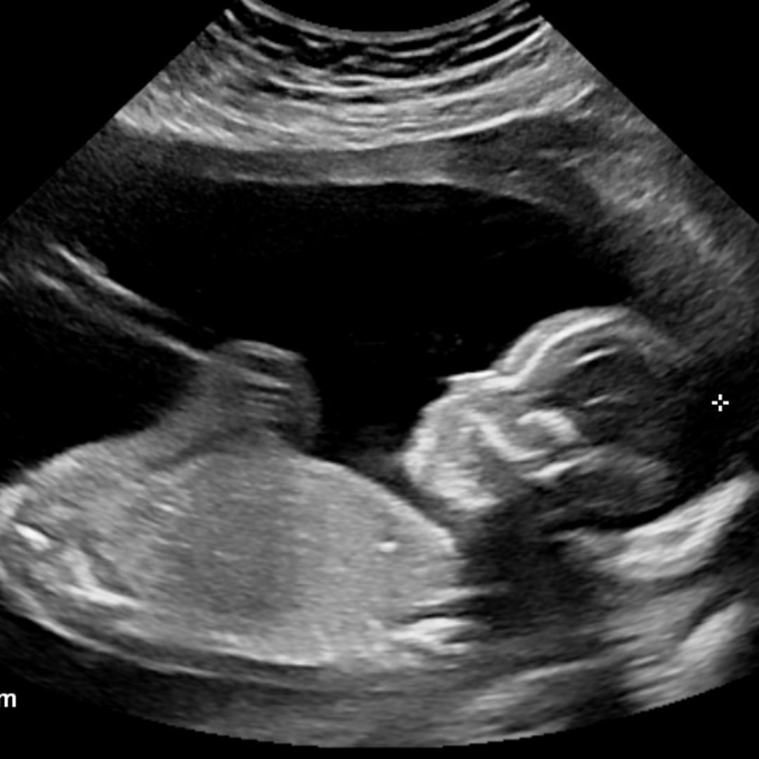 Photo shared by Annie for their Babylist baby registry.