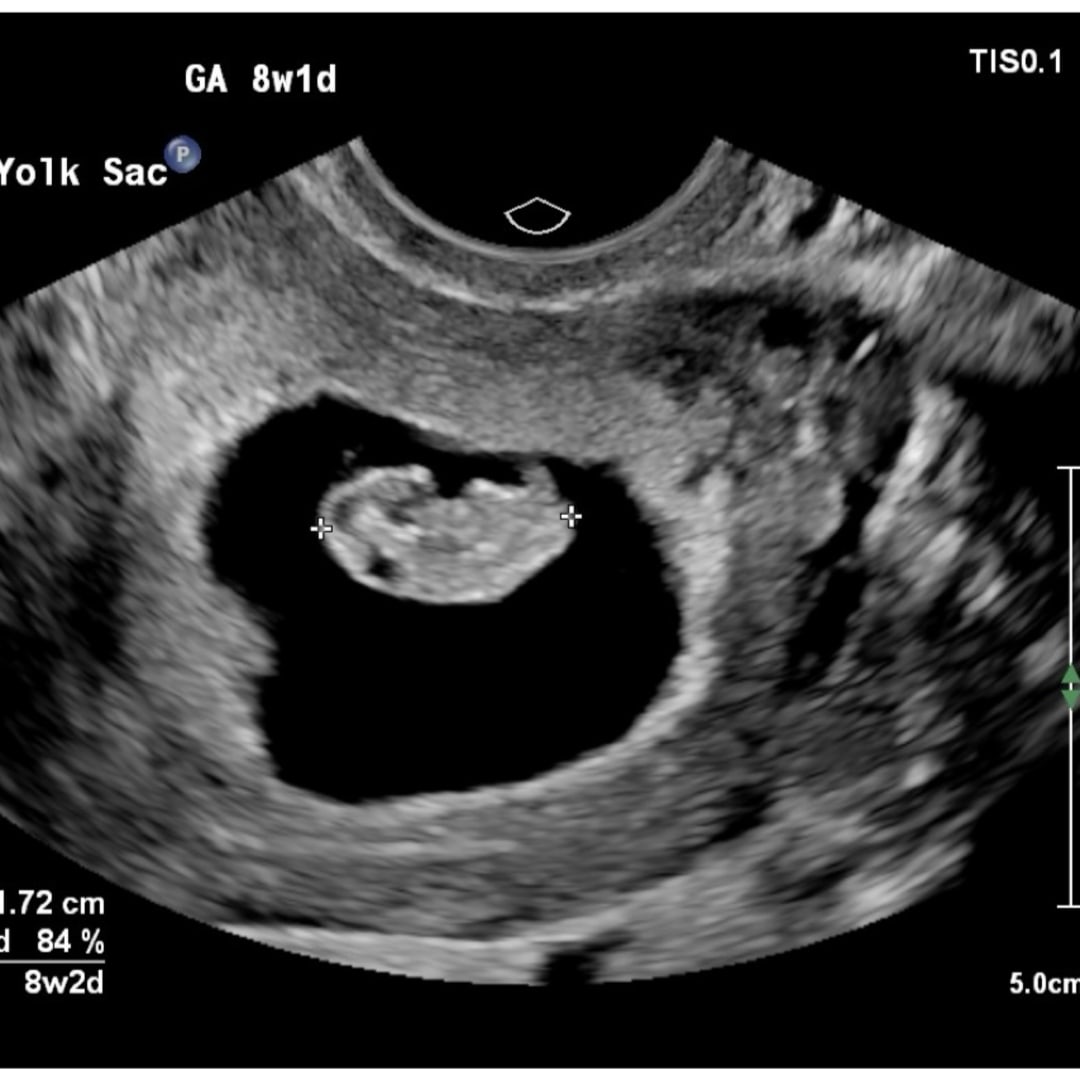 Photo shared by Breanna for their Babylist baby registry.