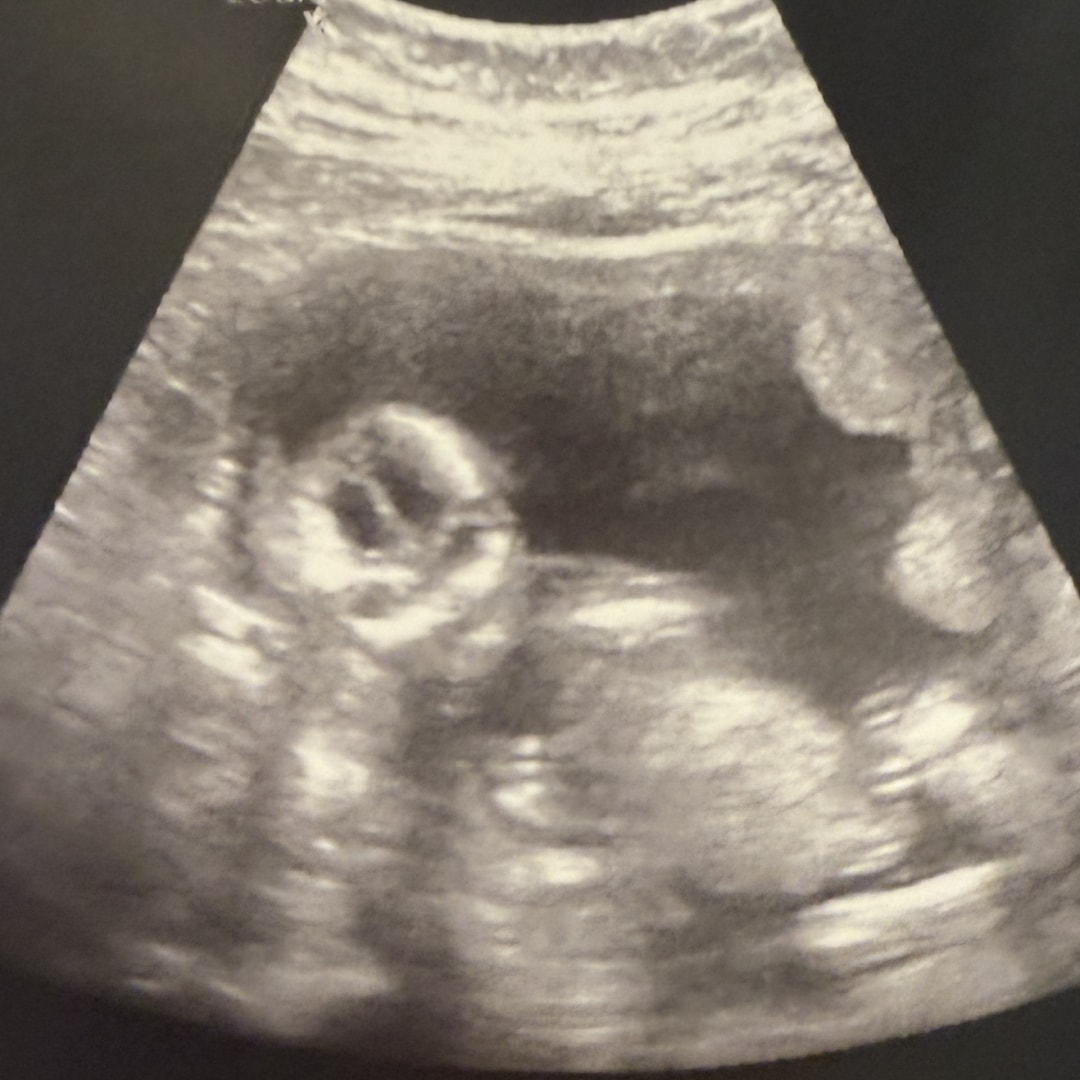 Photo shared by Dani for their Babylist baby registry.