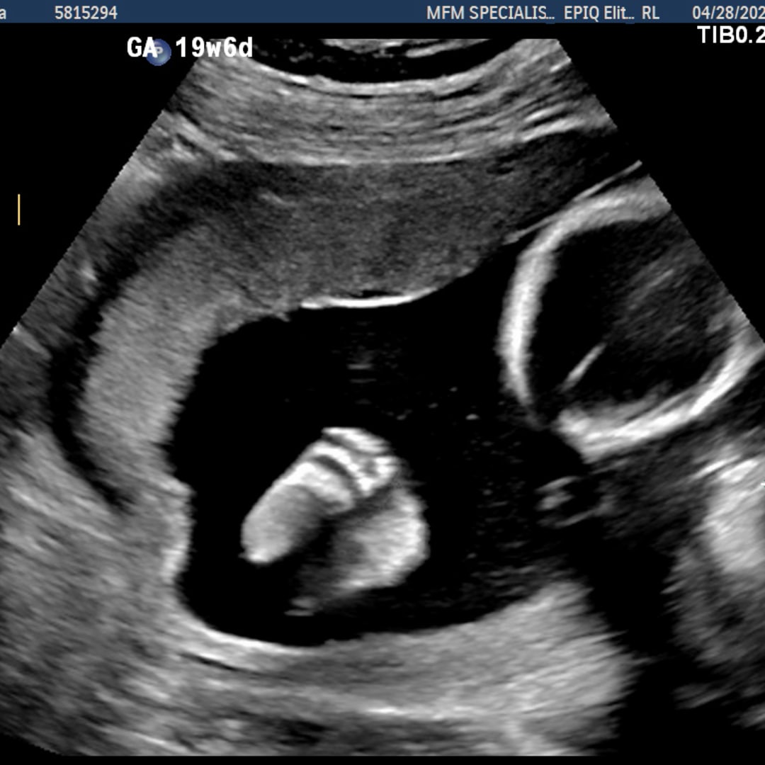 Photo shared by Bianca for their Babylist baby registry.