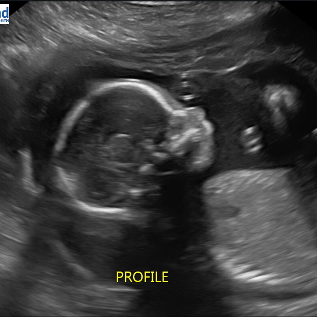 Photo shared by Jordan for their Babylist baby registry.