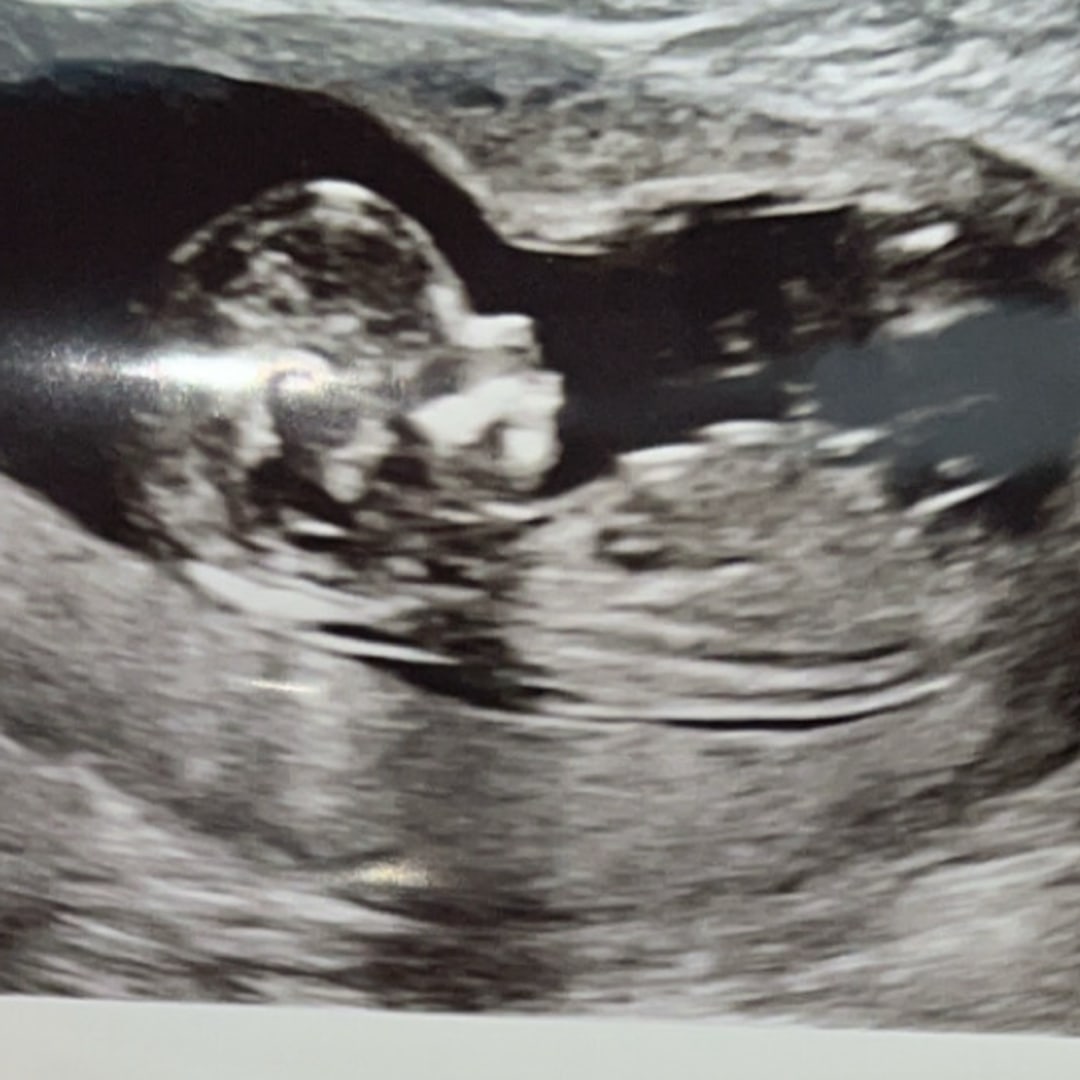 Photo shared by Sydney for their Babylist baby registry.