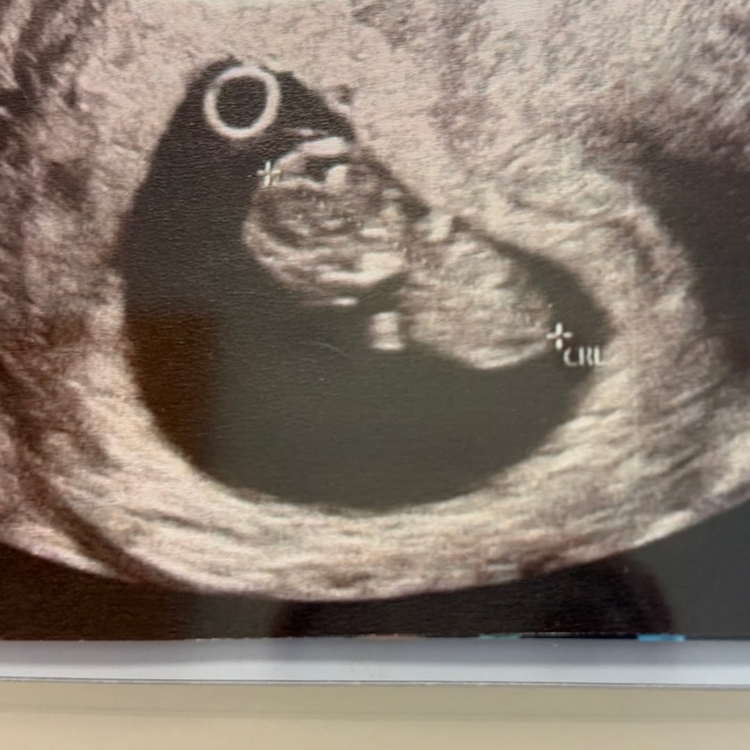 Photo shared by Denise for their Babylist baby registry.