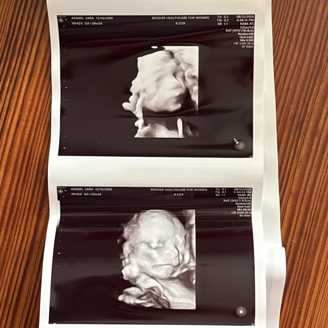 Photo shared by Sarah for their Babylist baby registry.