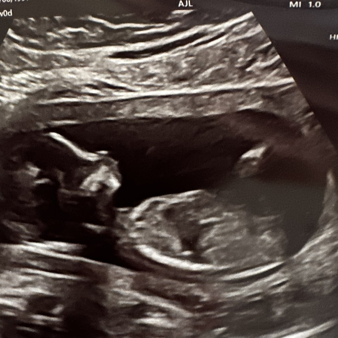 Photo shared by Charline for their Babylist baby registry.