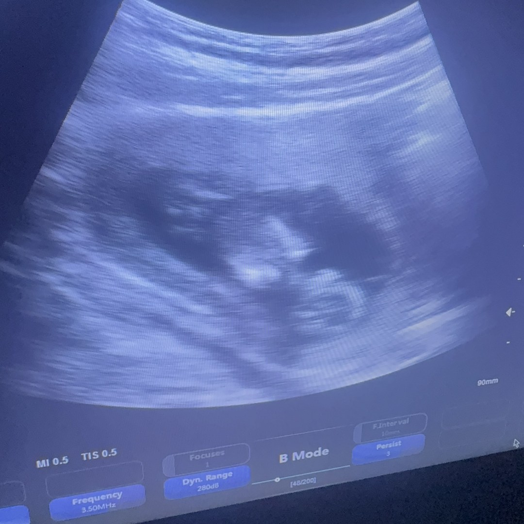 Photo shared by Cristina for their Babylist baby registry.
