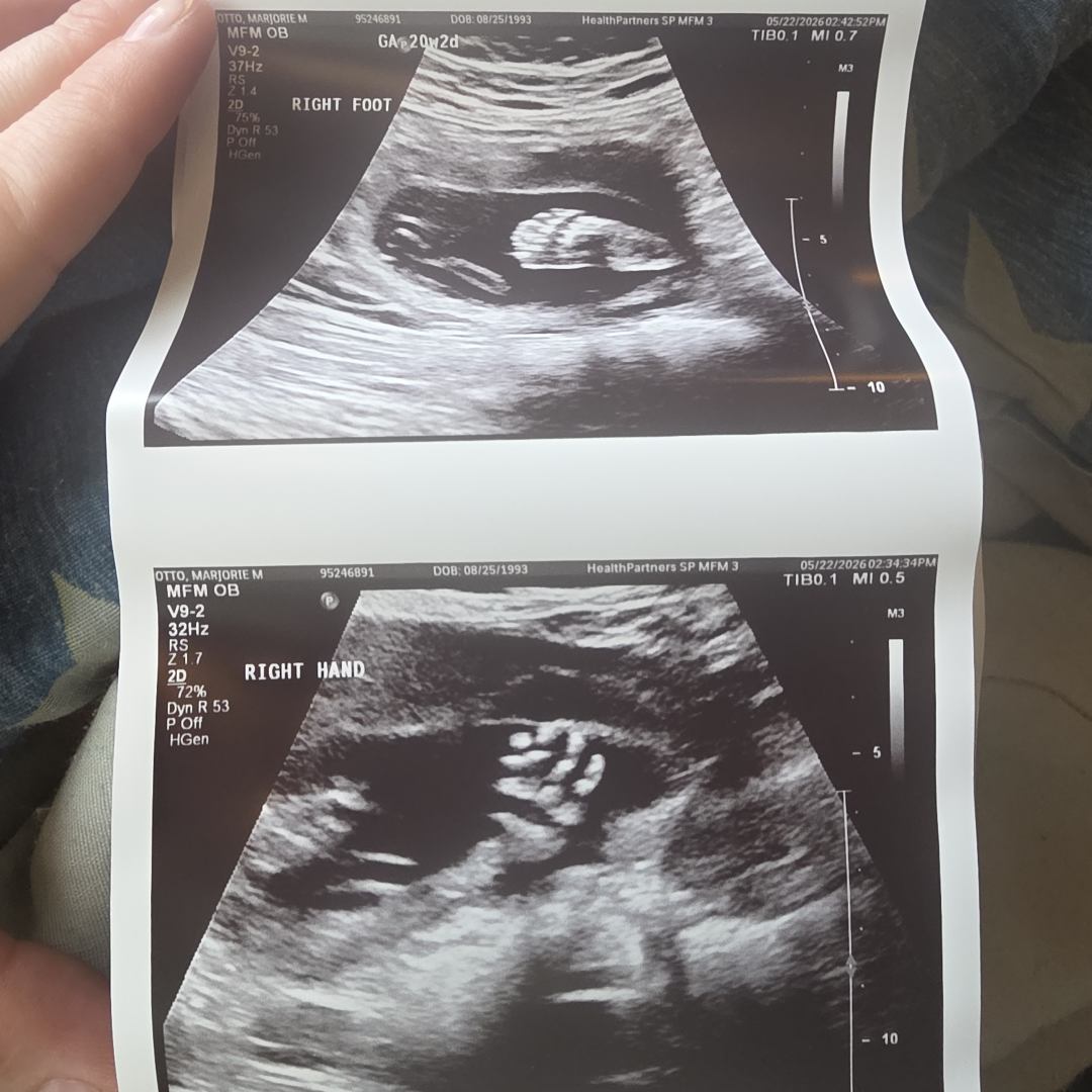 Photo shared by Marjorie for their Babylist baby registry.