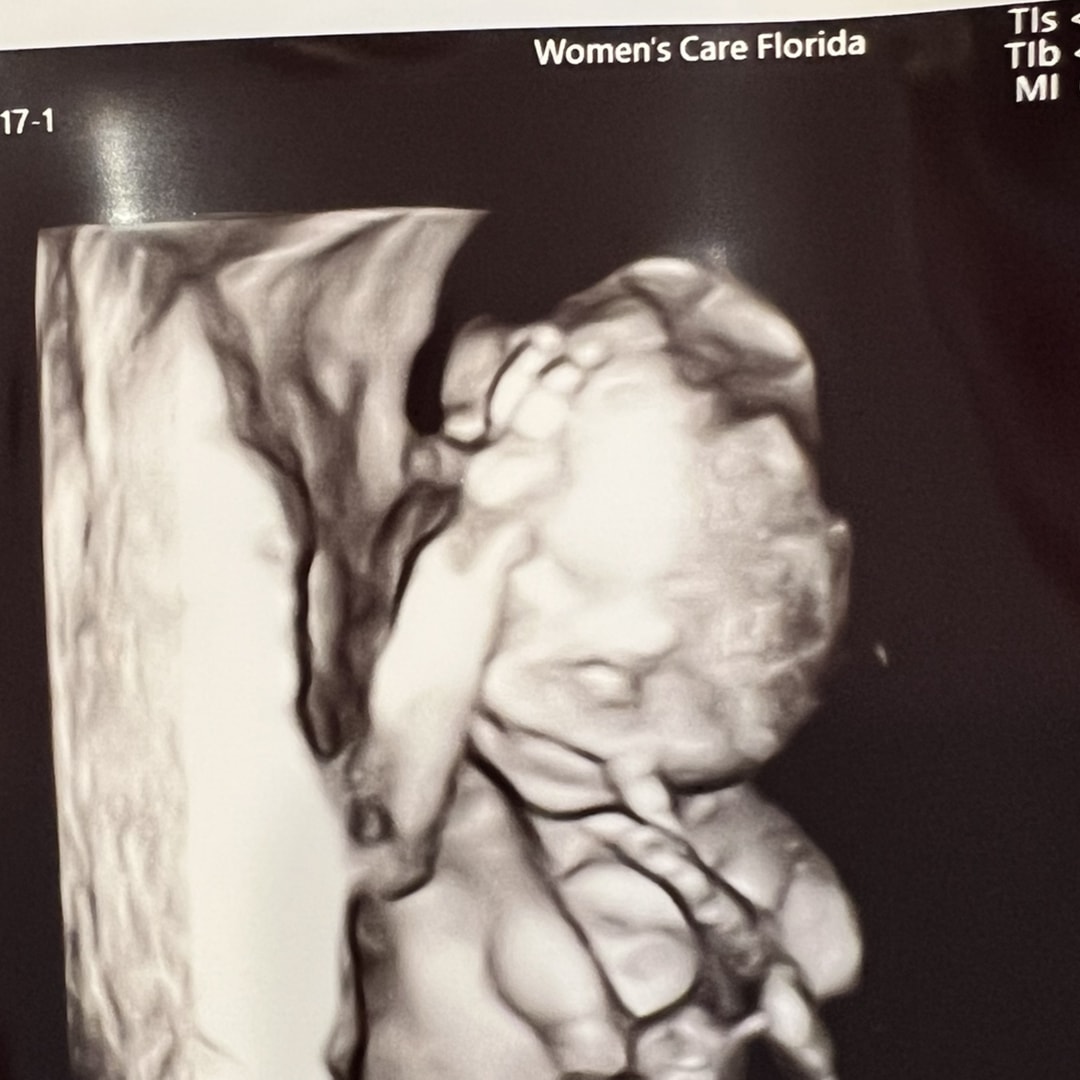 Photo shared by Courtney for their Babylist baby registry.