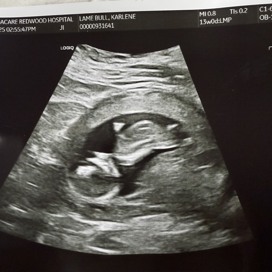 Photo shared by Karlene for their Babylist baby registry.