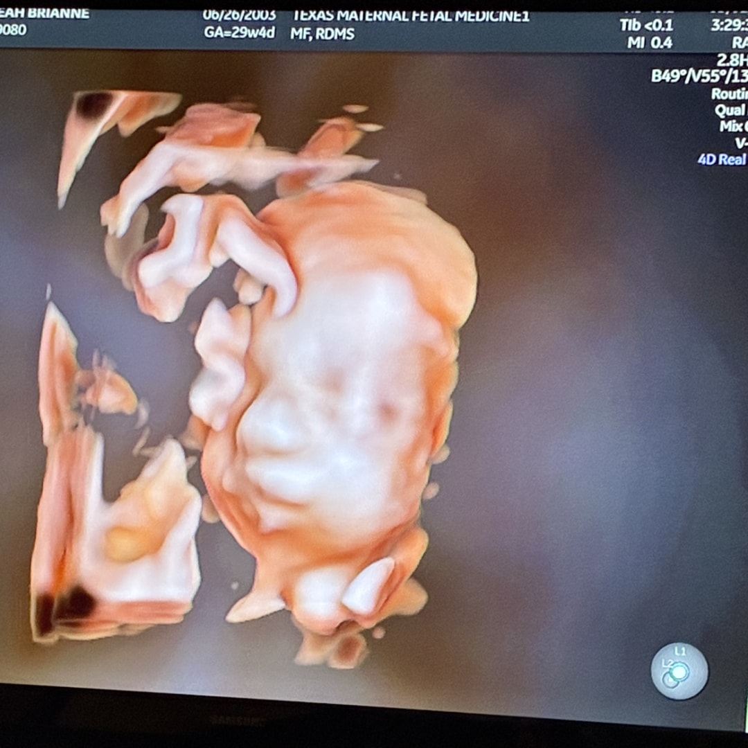 Photo shared by Leah for their Babylist baby registry.