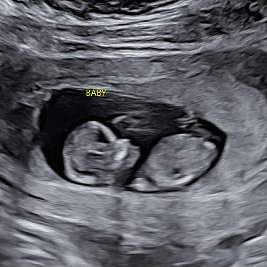 Photo shared by Shannon for their Babylist baby registry.