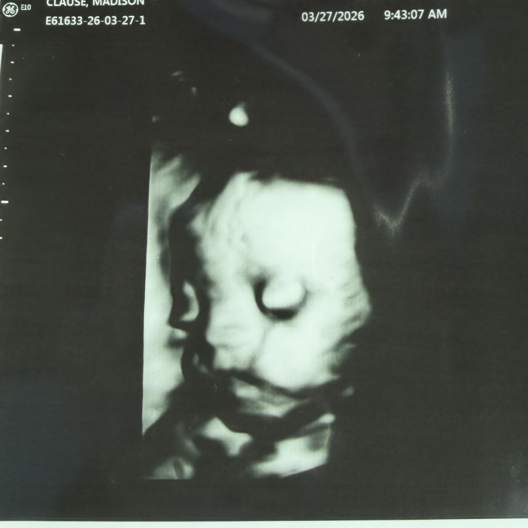 Photo shared by Madison for their Babylist baby registry.