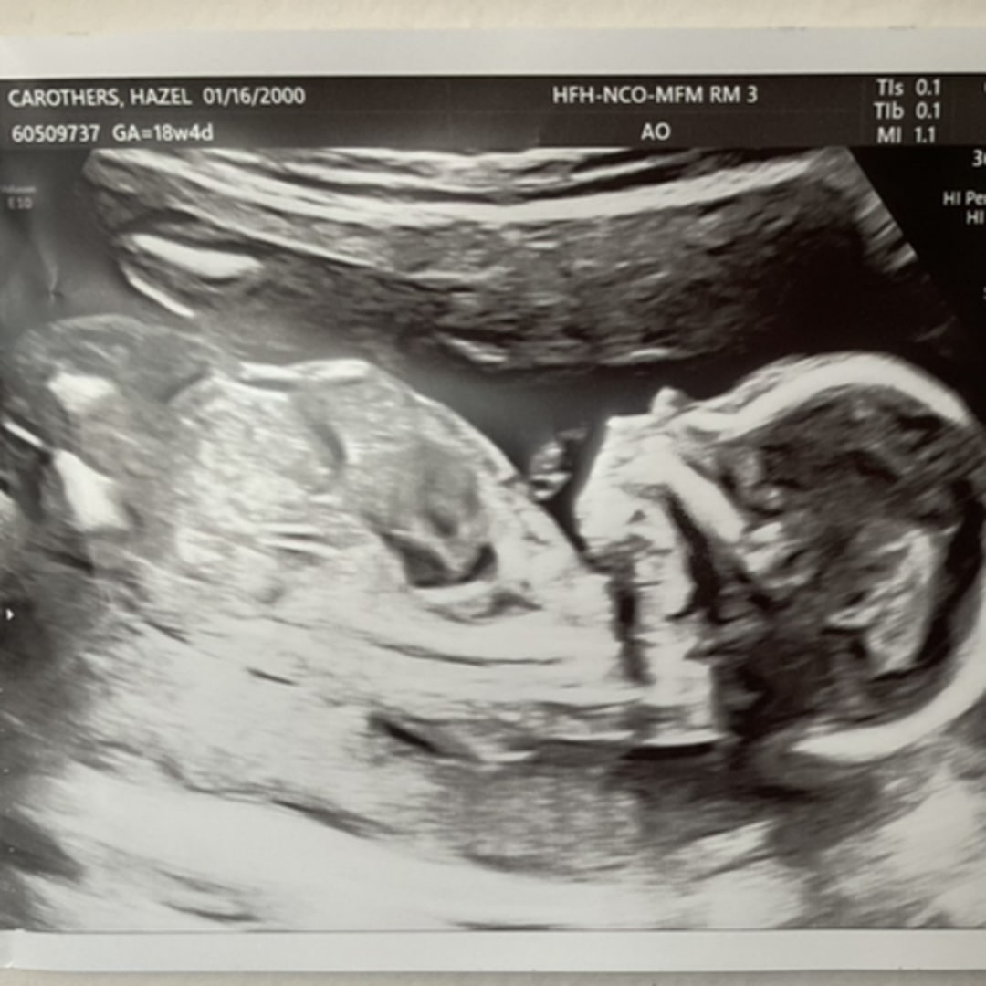 Photo shared by Hazel for their Babylist baby registry.