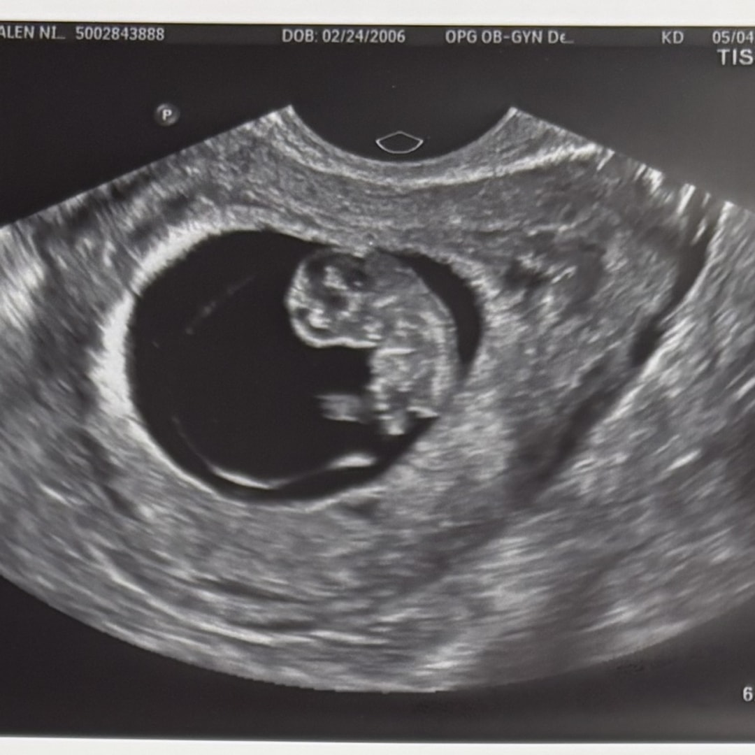 Photo shared by Matalen for their Babylist baby registry.