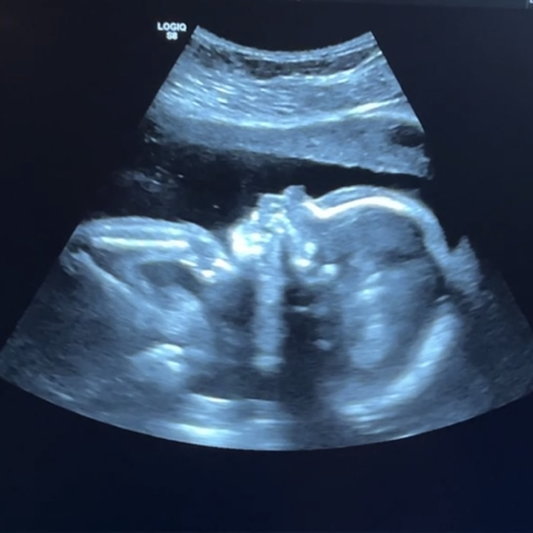 Photo shared by Bree for their Babylist baby registry.