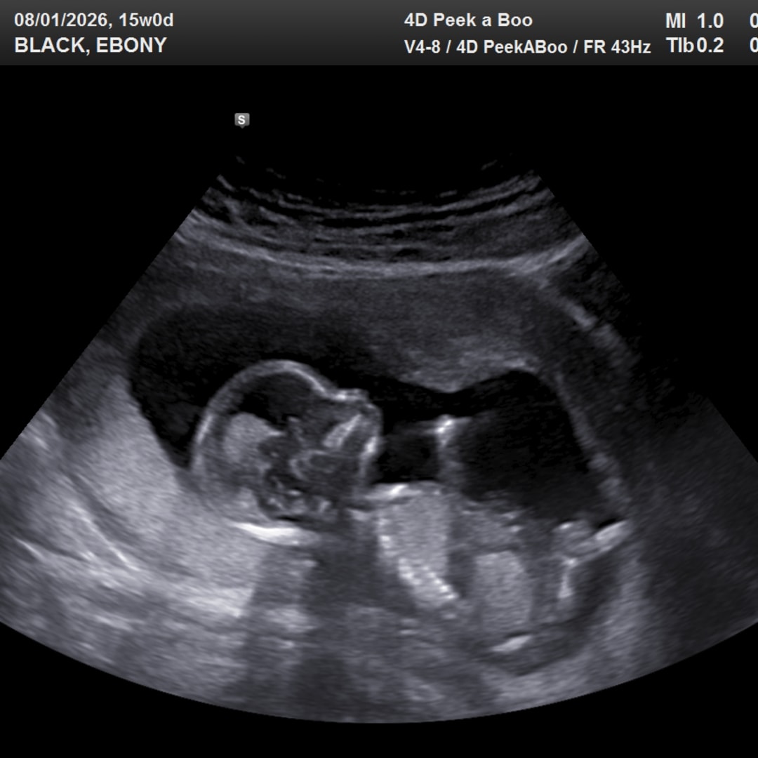 Photo shared by Ebony for their Babylist baby registry.