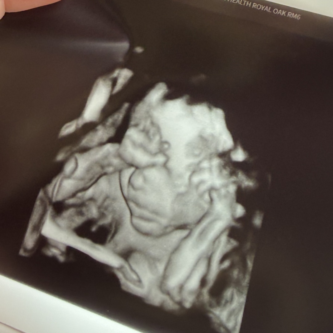 Photo shared by Baylee for their Babylist baby registry.