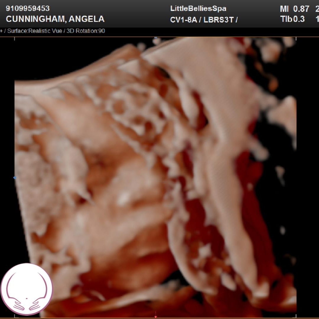 Photo shared by Angela for their Babylist baby registry.