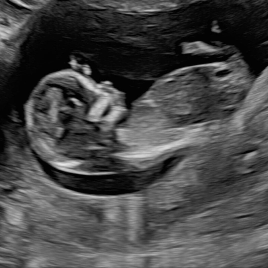 Photo shared by Julia for their Babylist baby registry.