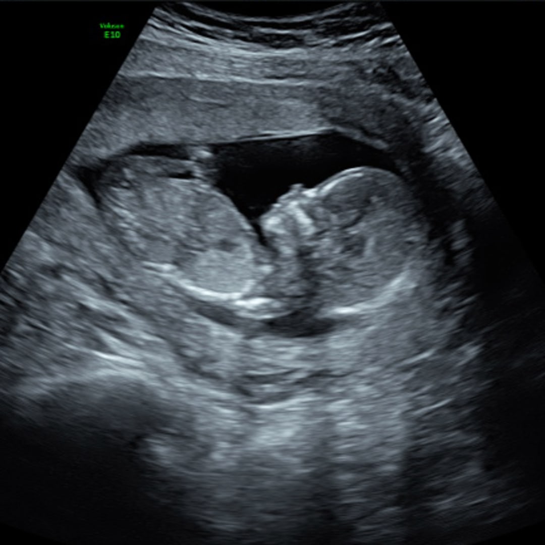 Photo shared by Jade for their Babylist baby registry.