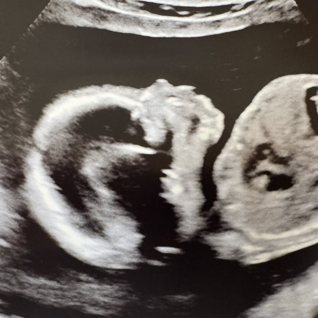 Photo shared by Regan for their Babylist baby registry.