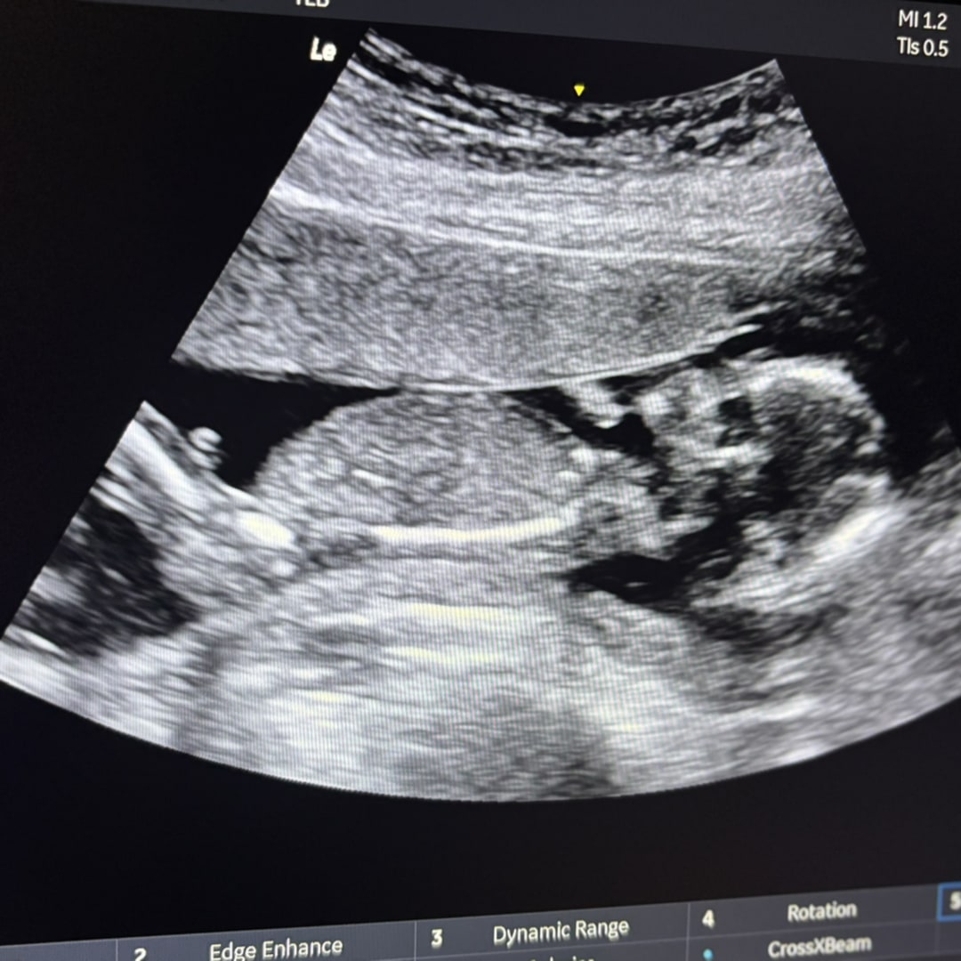 Photo shared by Aliyha for their Babylist baby registry.