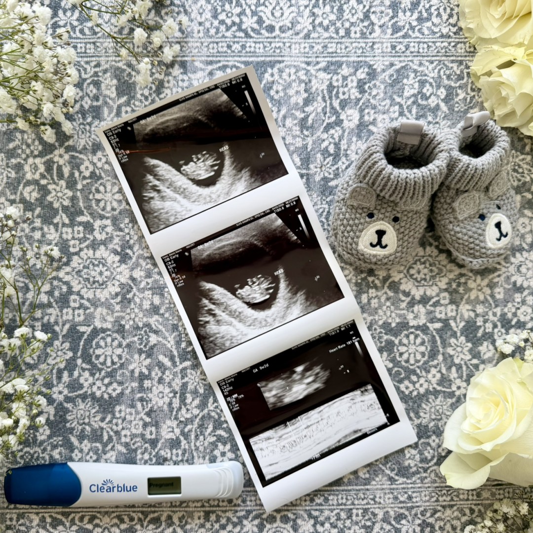 Photo shared by Alexis for their Babylist baby registry.