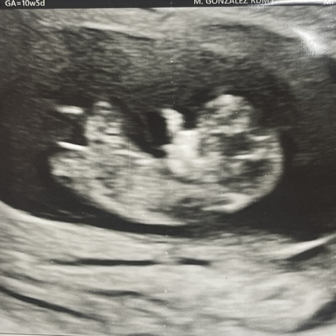 Photo shared by Isabelle for their Babylist baby registry.