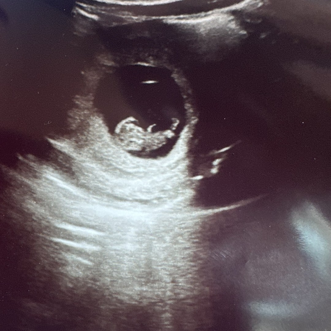 Photo shared by Emily for their Babylist baby registry.