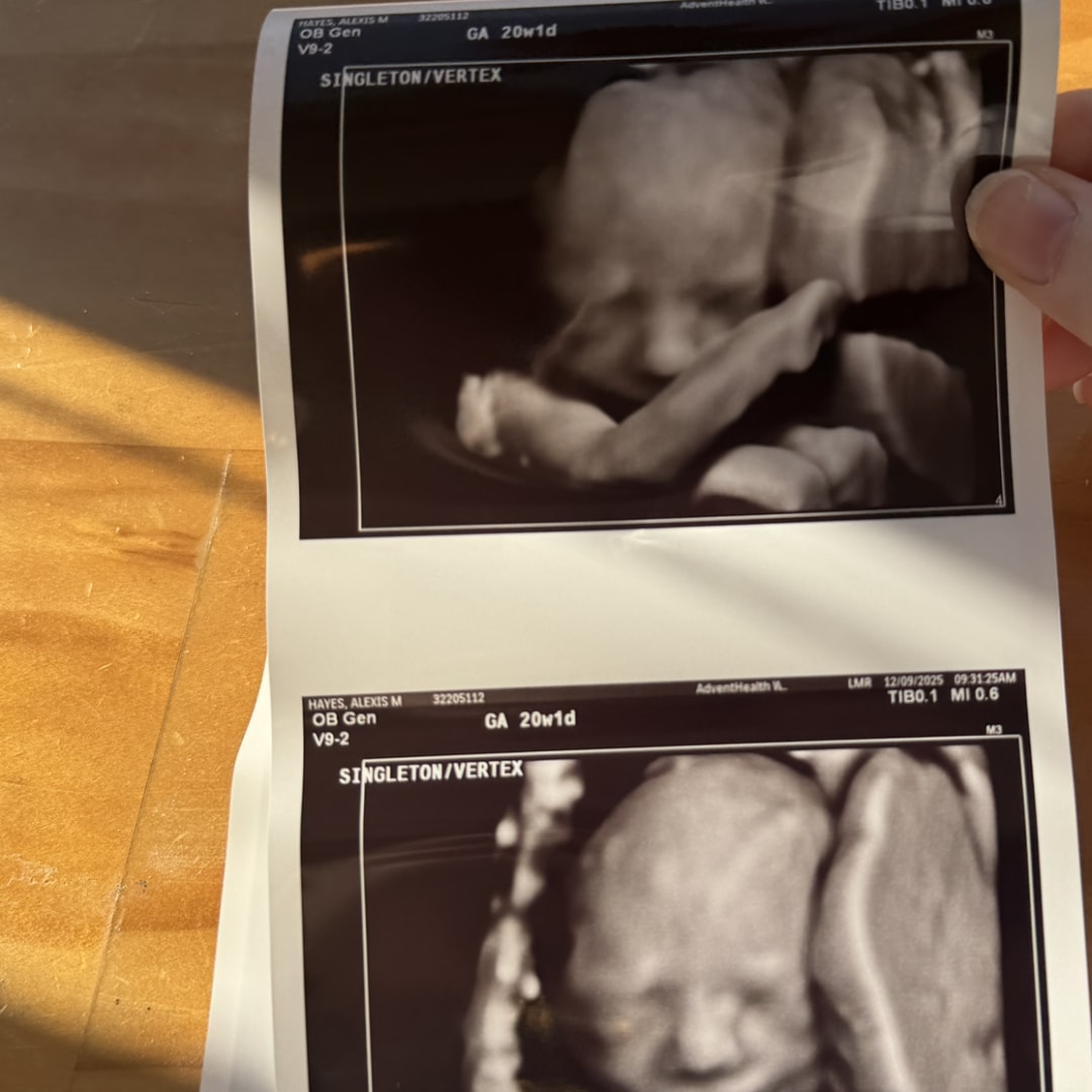 Photo shared by Alexis for their Babylist baby registry.