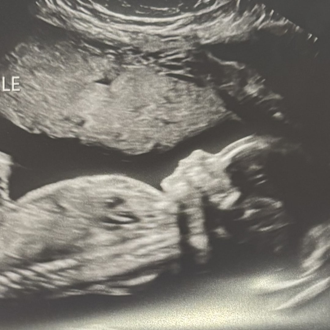 Photo shared by Ciara for their Babylist baby registry.