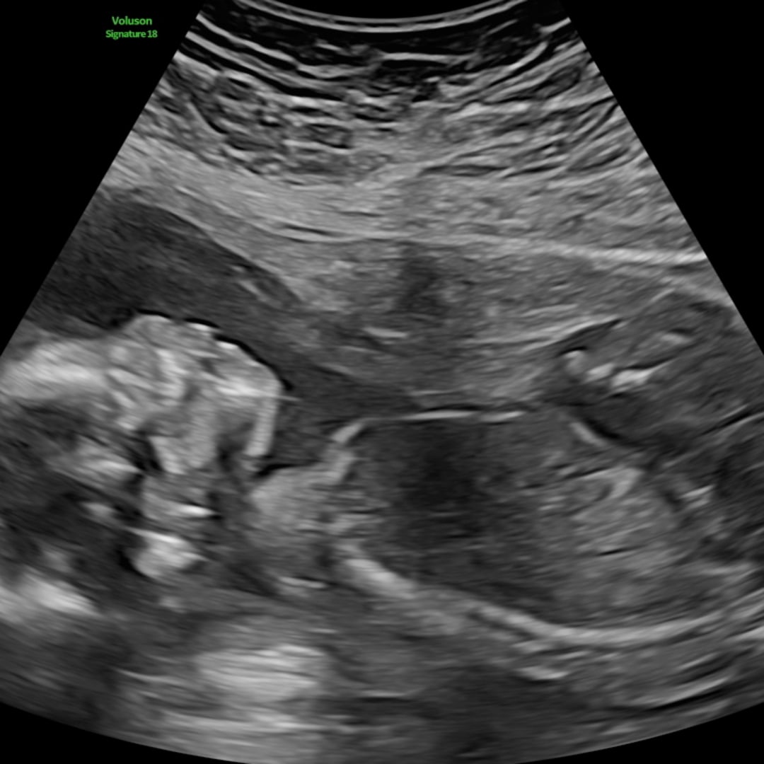 Photo shared by Ashly for their Babylist baby registry.