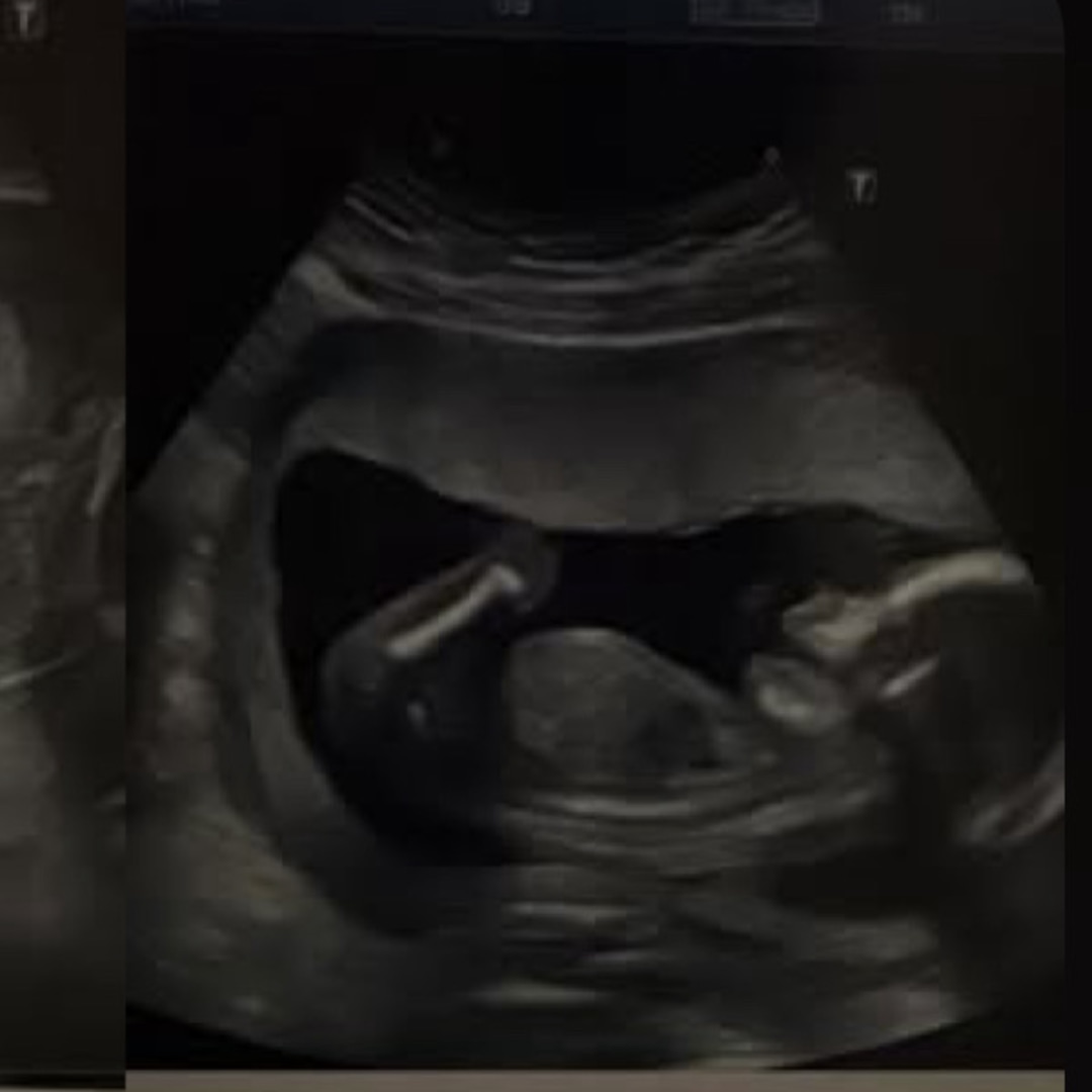 Photo shared by Kyla for their Babylist baby registry.