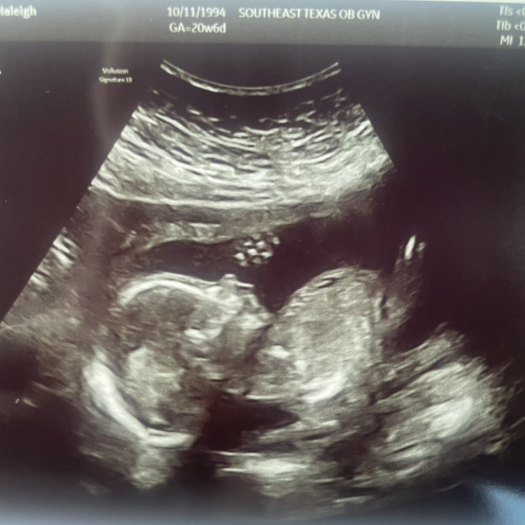Photo shared by Haleigh for their Babylist baby registry.