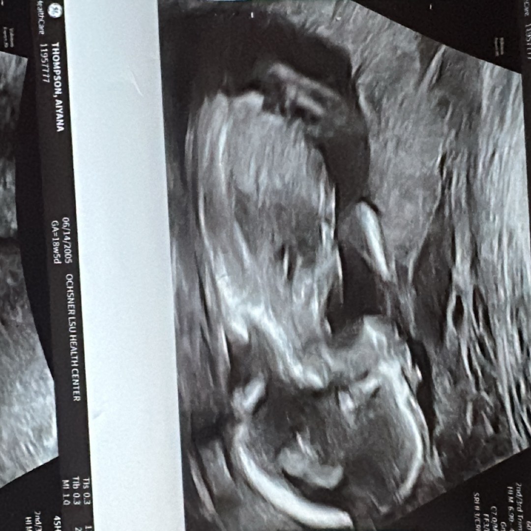 Photo shared by Aiyana for their Babylist baby registry.