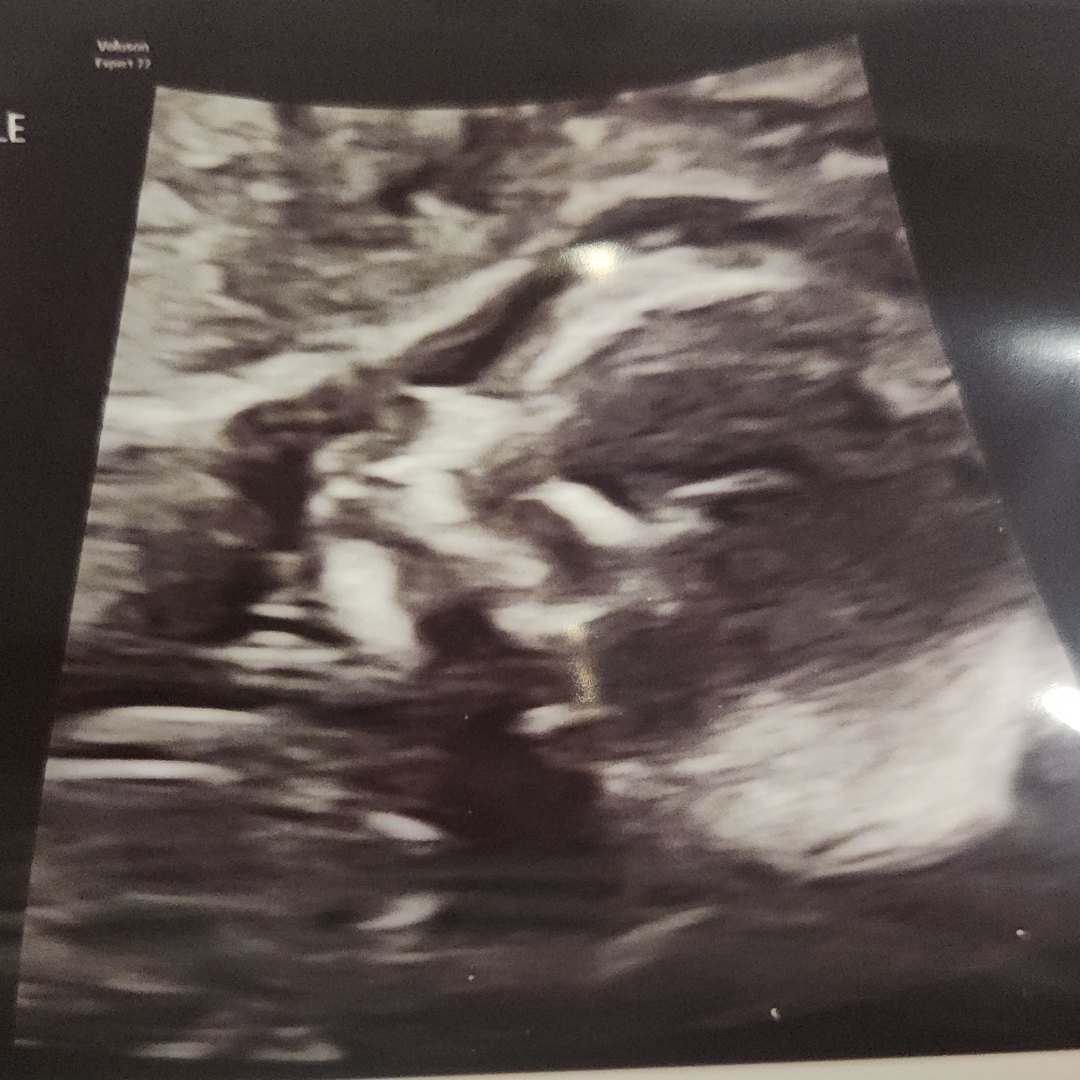 Photo shared by Erika for their Babylist baby registry.