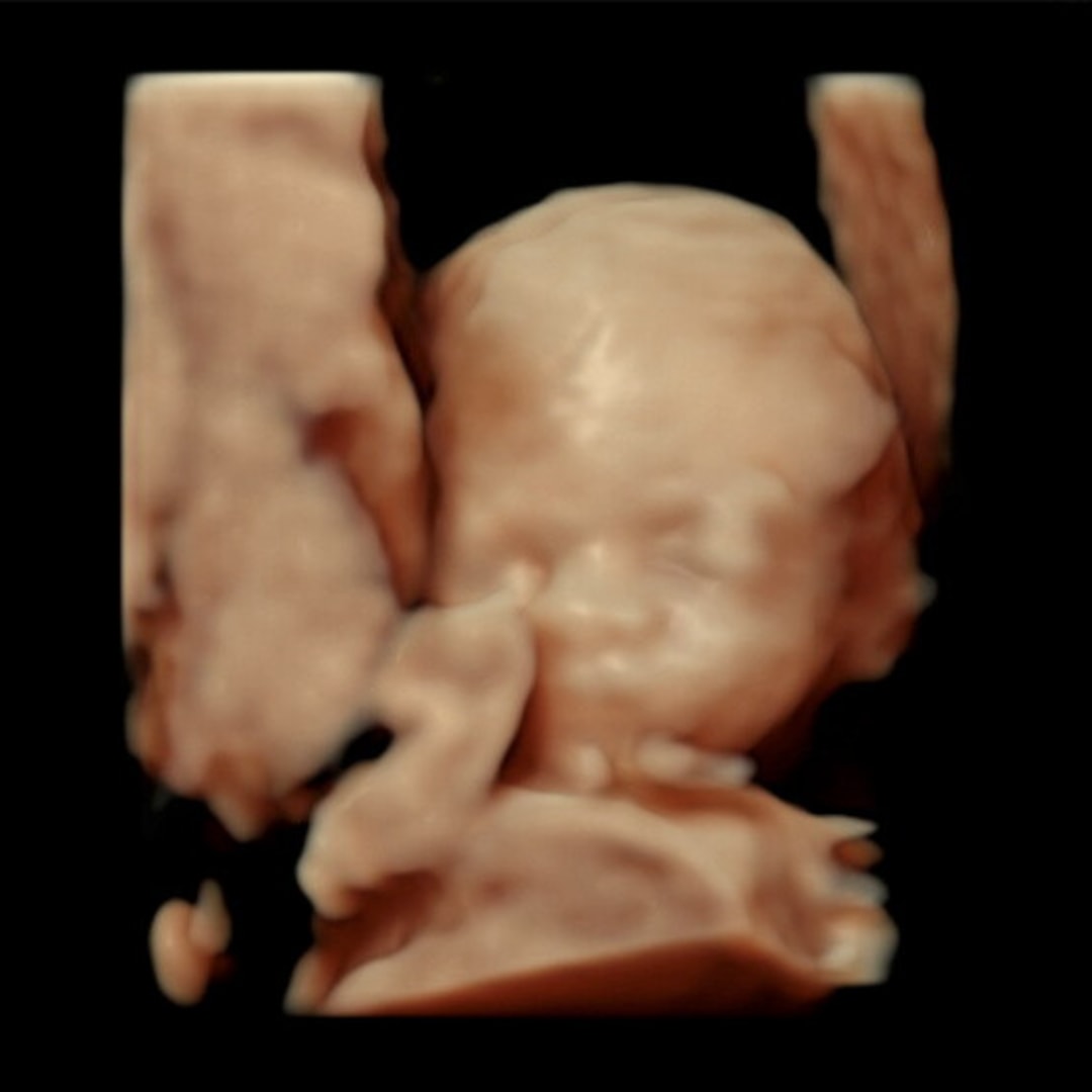 Photo shared by Anyi for their Babylist baby registry.