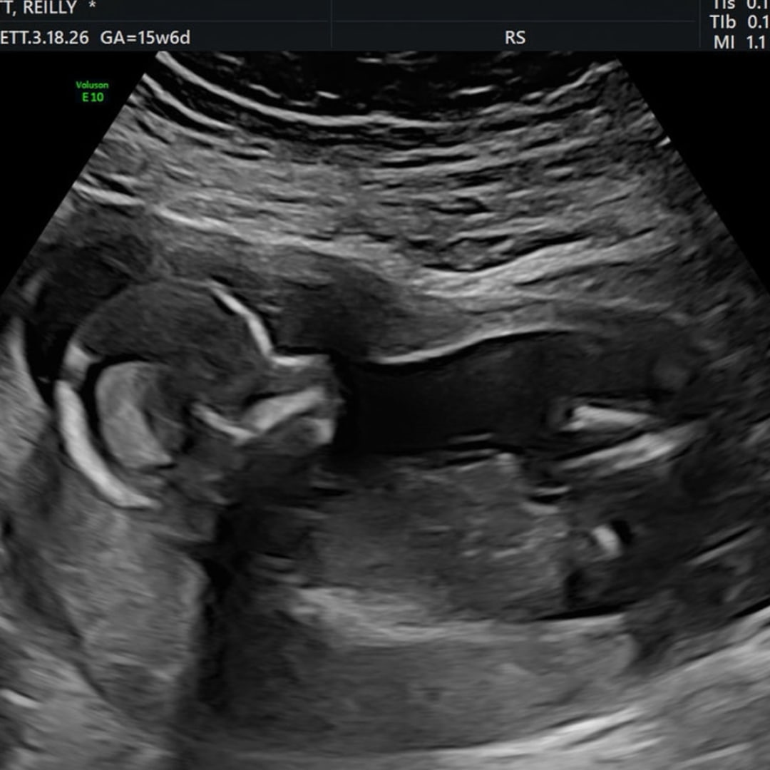 Photo shared by Reilly for their Babylist baby registry.