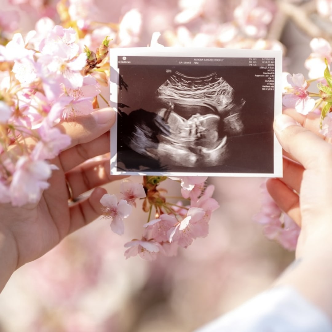 Photo shared by Isabella for their Babylist baby registry.