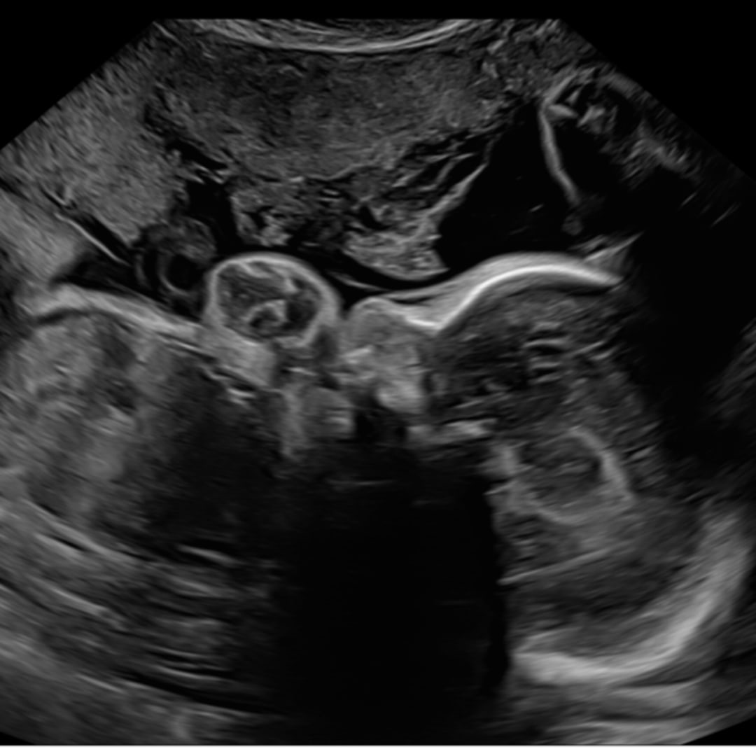 Photo shared by Alivia for their Babylist baby registry.
