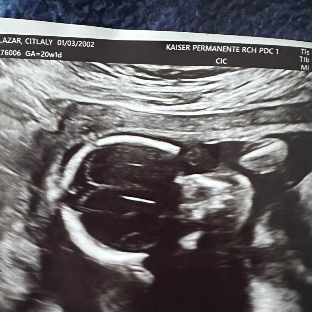 Photo shared by Citlaly for their Babylist baby registry.