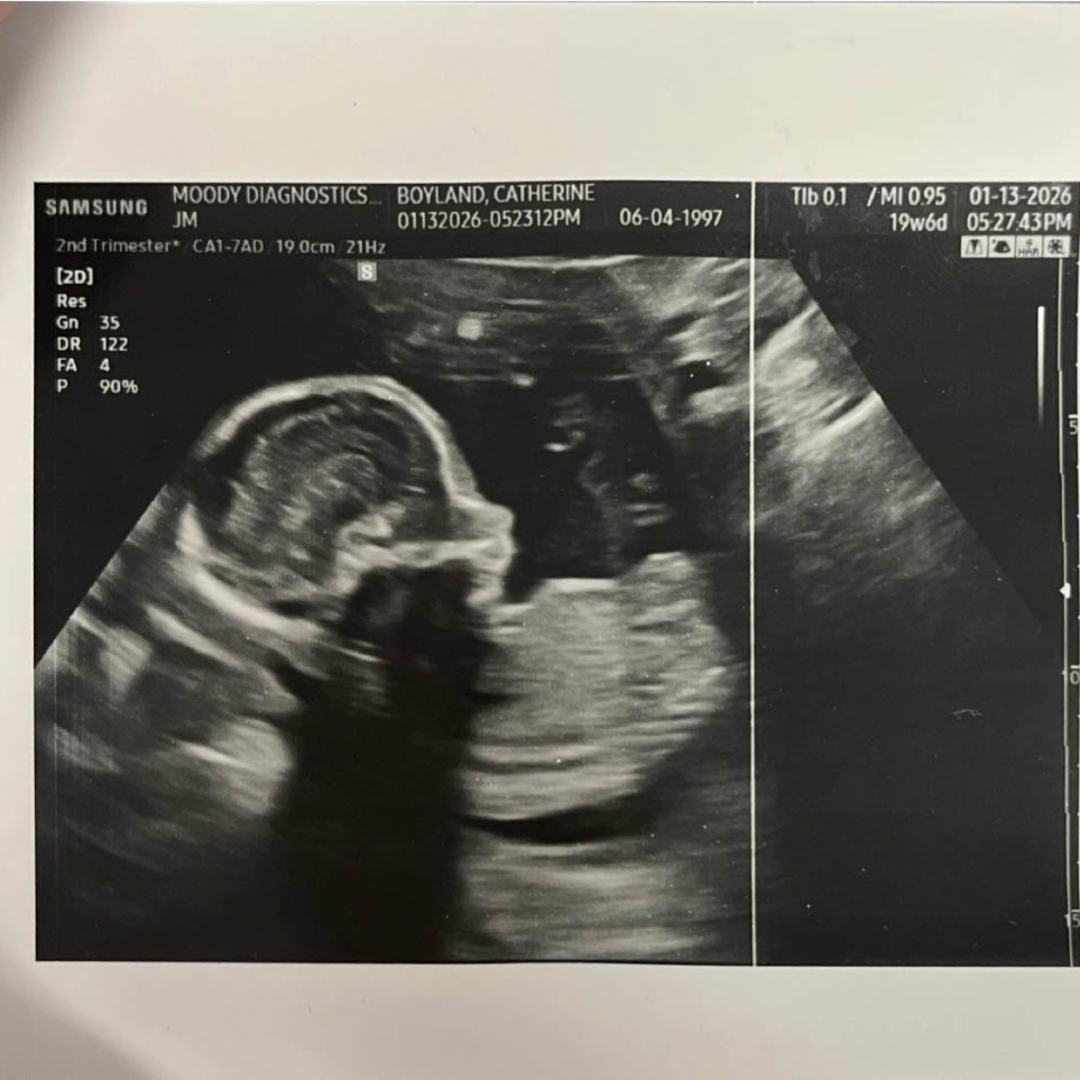 Photo shared by Catherine for their Babylist baby registry.